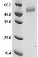 Human NKG2-E type II integral membrane protein (KLRC3), partial Recombinant Protein - BioCrest Sci
