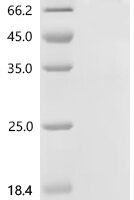 Human Complement factor B (CFB) Recombinant Protein, C-hFc1 - BioCrest Sci