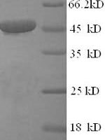 Human Citrate synthase, mitochondrial (CS), partial Recombinant Protein - BioCrest Sci