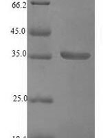 Lysobacter enzymogenes Beta-lytic metalloendopeptidase Recombinant Protein - BioCrest Sci