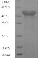Human F-box/LRR-repeat protein 18 (FBXL18), partial Recombinant Protein - BioCrest Sci
