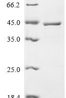 Human Estradiol 17-beta-dehydrogenase 1 (HSD17B1) Recombinant Protein - BioCrest Sci