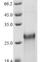 Human Protein PML (PML), partial Recombinant Protein - BioCrest Sci