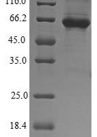 Human 5-aminolevulinate synthase, erythroid-specific, mitochondrial (ALAS2) Recombinant Protein - BioCrest Sci