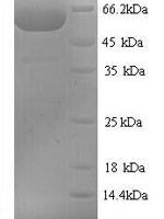 Chamaecyparis obtusa Polygalacturonase Recombinant Protein, N-His - BioCrest Sci