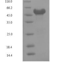 Human Nuclear receptor subfamily 2 group F member 6 (NR2F6) Recombinant Protein, N-His-Myc - BioCrest Sci