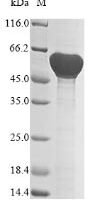 Bacillus subtilis D-alanine--D-alanyl carrier protein ligase (dltA) Recombinant Protein - BioCrest Sci