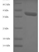 Human 39S ribosomal protein L42, mitochondrial (MRPL42) Recombinant Protein - BioCrest Sci