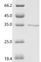 Human Protein-lysine 6-oxidase (LOX), partial Recombinant Protein, C-His - BioCrest Sci
