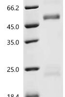 Rat Coagulation factor X (F10) Recombinant Protein, C-10His - BioCrest Sci