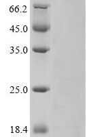 Human coronavirus HKU1 Non-structural protein 4 (4) Recombinant Protein, C-His, aa 1–109, Yeast, UniProt Q0ZME6 - BioCrest Sci