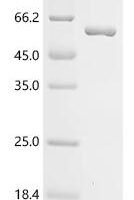 Vaccinia virus Envelope protein H3 (OPG108) (X27S,X28S,X29S), partial, Biotinylated Recombinant Protein - BioCrest Sci