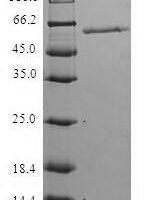 Human Hermansky-Pudlak syndrome 1 protein (HPS1) Recombinant Protein - BioCrest Sci