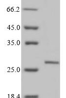 Rat Sclerostin domain-containing protein 1 (Sostdc1) Recombinant Protein, N-10His/C-Myc, aa 24–206, Mammalian cell - BioCrest Sci