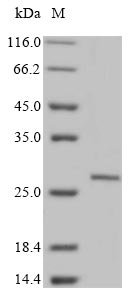 Rat Sclerostin domain-containing protein 1 (Sostdc1) Recombinant Protein, N-10His/C-Myc, aa 24–206, Mammalian cell, Rattus norvegicus (Rat), Mammalian cell, N-terminal 10xHis-tagged and C-terminal Myc-tagged, 24.6 kDa, purity >≥ 85% as determined by SDS-PAGE.