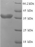 Escherichia coli O6:H1 Lipopolysaccharide export system protein LptC (lptC) Recombinant Protein, N-His-SUMO - BioCrest Sci