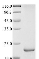 Saccharomyces cerevisiae Nucleoside diphosphate kinase (YNK1) Recombinant Protein, N-His - BioCrest Sci