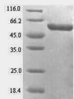 Rat Mucosal addressin cell adhesion molecule 1 (Madcam1), partial Recombinant Protein - BioCrest Sci