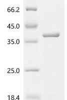 Helicobacter pylori Flagellin A (flaA), partial Recombinant Protein - BioCrest Sci