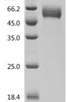 Mouse Interleukin-1 receptor type 1 (Il1r1), partial Recombinant Protein - BioCrest Sci