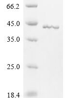 Apis mellifera Arginine kinase (ARGK) Recombinant Protein - BioCrest Sci