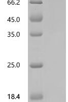 Mouse Coagulation factor XI  (F11) Recombinant Protein - BioCrest Sci