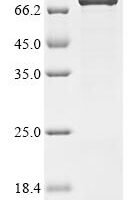 Human Junctional protein associated with coronary artery disease (JCAD), partial Recombinant Protein - BioCrest Sci
