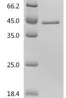 Saccharomyces cerevisiae Serine/threonine-protein phosphatase PP1-2 (GLC7) Recombinant Protein - BioCrest Sci