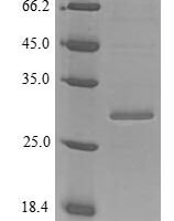 Mouse Tenascin (Tnc), partial Recombinant Protein - BioCrest Sci