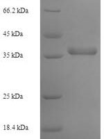 Human DNA replication complex GINS protein PSF2 (GINS2) Recombinant Protein - BioCrest Sci