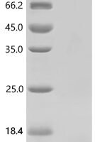 Shigella flexneri Aquaporin Z (aqpZ), partial Recombinant Protein - BioCrest Sci