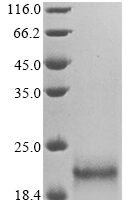 Human papillomavirus type 16 Protein E7 (E7) Recombinant Protein, N-His - BioCrest Sci