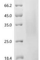 Human Vesicle-associated membrane protein-associated protein A (VAPA), partial Recombinant Protein, C-His, aa 2–227, Yeast - BioCrest Sci