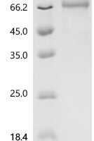 Human Putative butyrophilin-like protein 10 pseudogene (BTNL10P), partial Recombinant Protein, C-hFc1 - BioCrest Sci