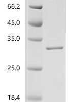 Mouse Fibroblast growth factor 15 (Fgf15) Recombinant Protein - BioCrest Sci