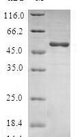 Human Ras-related protein Ral-B (RALB) Recombinant Protein - BioCrest Sci