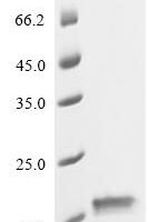 Escherichia coli Colicin-E9 immunity protein (imm) Recombinant Protein - BioCrest Sci