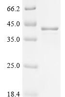 Mouse Midkine (Mdk) Recombinant Protein, N-10His-EGFP - BioCrest Sci