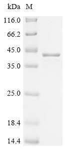 Mouse Midkine (Mdk) Recombinant Protein, N-10His-EGFP, Mus musculus (Mouse), E.coli, N-terminal 10xHis-EGFP-tagged, 41.6 kDa, purity >≥ 85% as determined by SDS-PAGE.