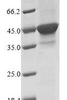 Dictyostelium discoideum DNA-dependent protein kinase catalytic subunit (dnapkcs), partial Recombinant Protein - BioCrest Sci