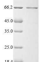 Human Cystathionine beta-synthase (CBS), partial Recombinant Protein - BioCrest Sci