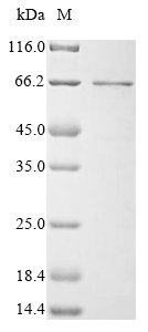 Human Cystathionine beta-synthase (CBS), partial Recombinant Protein, Homo sapiens (Human), E.coli, N-terminal 6xHis-SUMO-tagged, 61.4 kDa, purity >≥ 90% as determined by SDS-PAGE.