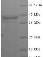 Mycoplasma sp.Modification methylase MunI (munIM) Recombinant Protein - BioCrest Sci