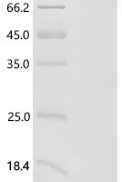 Human Proto-oncogene c-Rel (REL), partial Recombinant Protein, C-His - BioCrest Sci