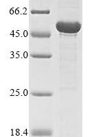 Schizosaccharomyces pombe L-saccharopine oxidase (fap2) Recombinant Protein - BioCrest Sci