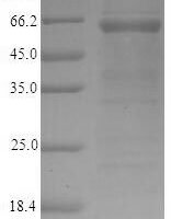 Mouse Golgi membrane protein 1 (Golm1), partial Recombinant Protein - BioCrest Sci