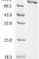 Escherichia coli Trehalose-6-phosphate phosphatase (otsB) Recombinant Protein, C-10His-HSA - BioCrest Sci