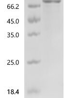 Human A disintegrin and metalloproteinase with thrombospondin motifs 18 (ADAMTS18), partial Recombinant Protein, C-His - BioCrest Sci