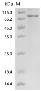 Human A disintegrin and metalloproteinase with thrombospondin motifs 18 (ADAMTS18), partial Recombinant Protein, C-His, Homo sapiens (Human), E.coli, C-terminal 6xHis-tagged, 73.8 kDa, purity >≥ 85% as determined by SDS-PAGE.