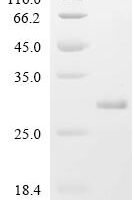 Human Probable palmitoyltransferase ZDHHC12 (ZDHHC12), partial Recombinant Protein - BioCrest Sci
